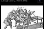 옛날 유럽의 요로결석 치료법